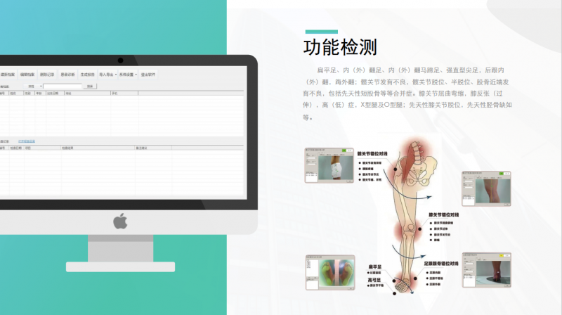 下肢關節(jié)對線及足底壓力分布檢測設備-