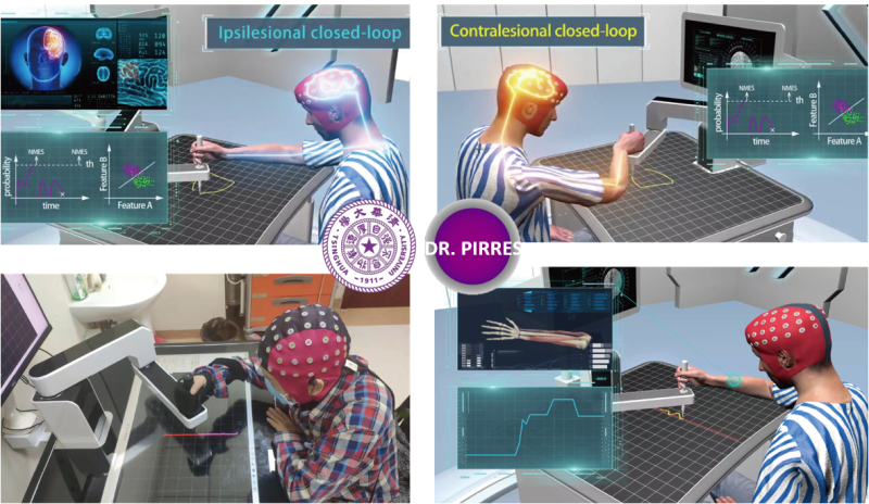 智能精準(zhǔn)康復(fù)機(jī)器人專(zhuān)家系統(tǒng)-